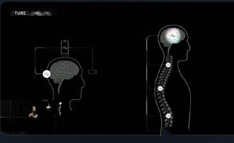 美国科技巨头马斯克Neuralink获FDA批准启动首个人体临床研究，迈向脑机接口里程碑