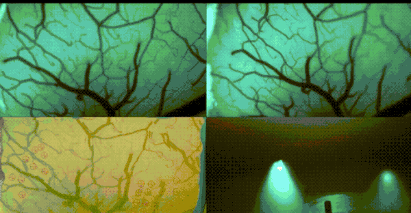 Neuralink的又一里程碑：马斯克确认计划2025年为患者实施脑机接口植入_Neuralink的又一里程碑：马斯克确认计划2025年为患者实施脑机接口植入_Neuralink的又一里程碑：马斯克确认计划2025年为患者实施脑机接口植入